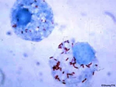 Des chercheurs de l'Université d'État de Caroline du Nord ont identifié une nouvelle espèce de bactéries Rickettsia qui pourrait être à l’origine de maladies importantes chez les chiens et les humains